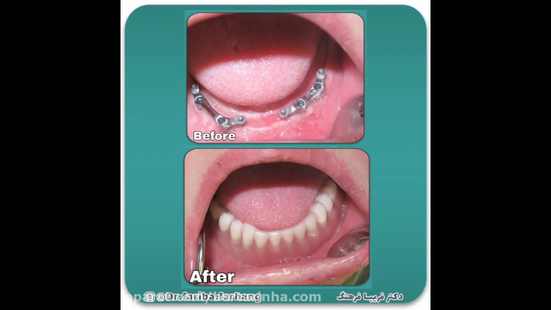 قبل و بعد کار 2