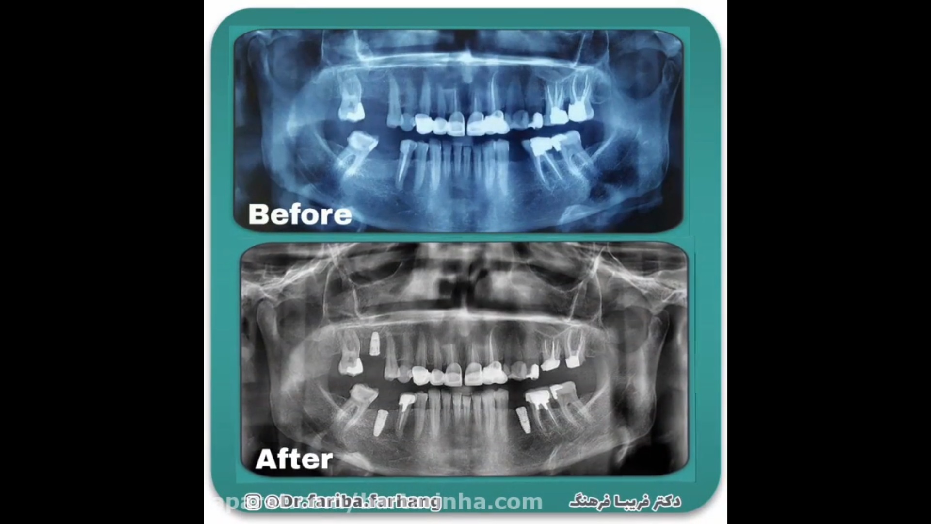 قبل و بعد کار 1