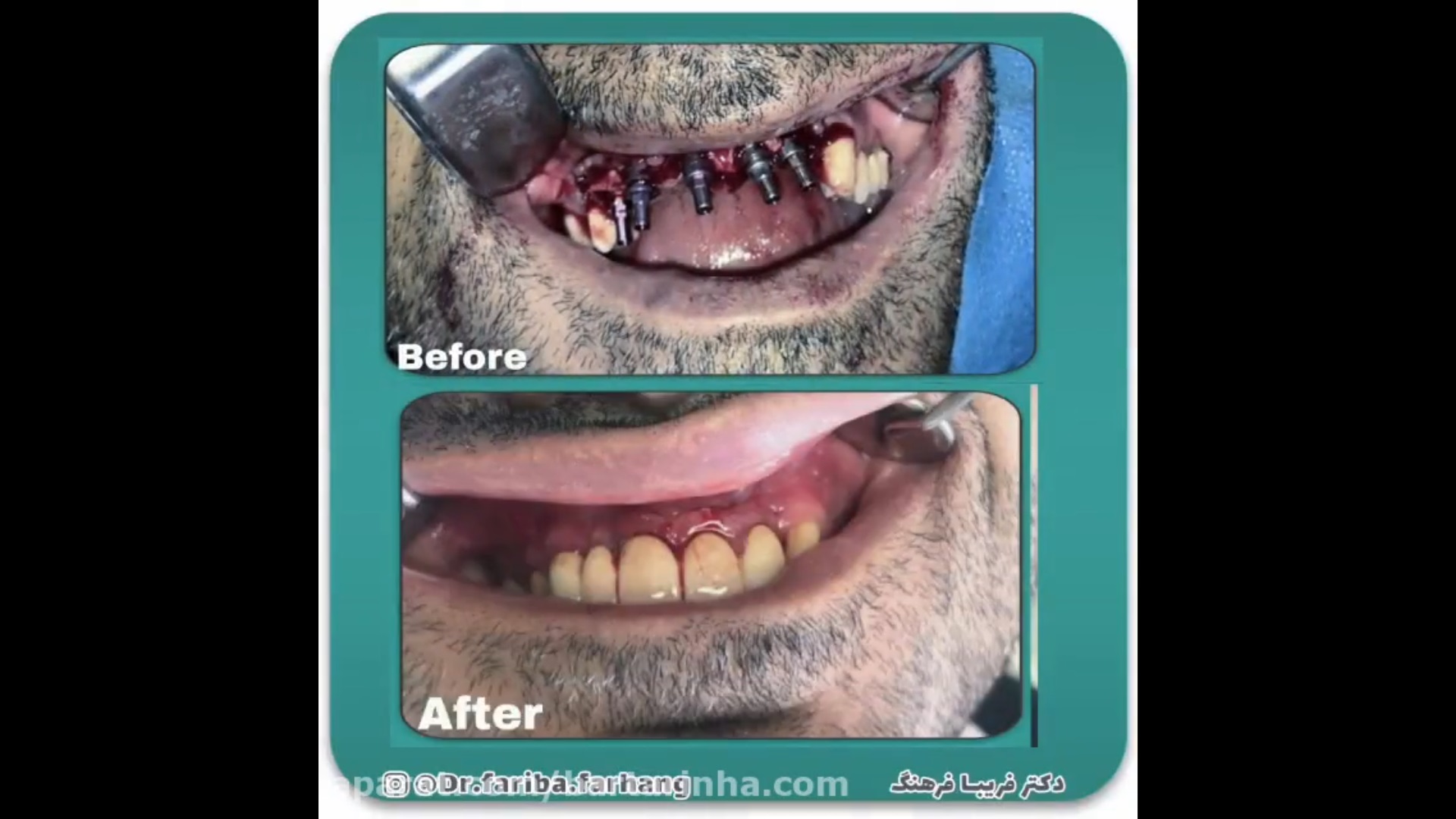 قبل و بعد کار 3